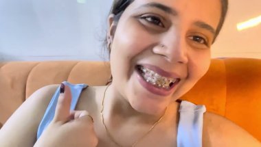 Braces update #viral #dentist#teeth #youtube #smiledesigndental #dentalprosthesis