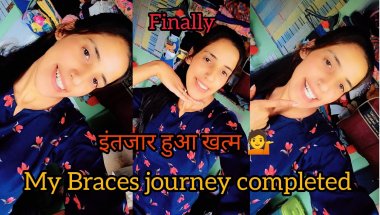Finally। मेरा इंतजार हुआ खत्म 💁my braces journey completed 😊ll#phadilifestyle #dellyvlog #