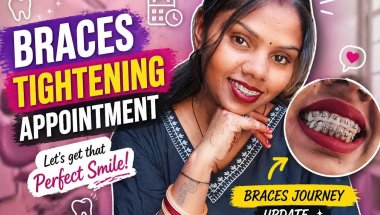 Braces Tightening Appointment 😬 | Painful or Not? | Braces Journey Update