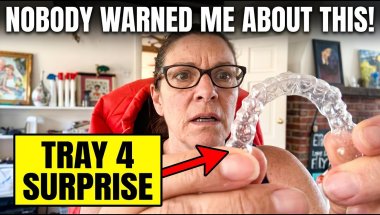Tray 4 Shocked Me - Nobody Warned Me About THIS | Invisalign