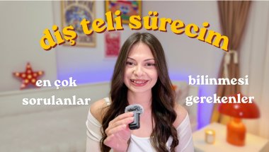 Tel taktırmadan önce bilinmesi gerekenler / en çok sorduğunuz sorular, benim sürecim 🦷