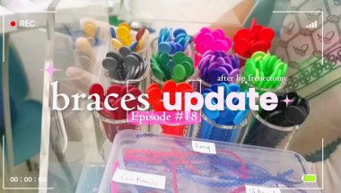 #BracesUpdate🦷: Adjustment | Buccal Tube & Bracket Reattachment