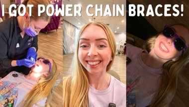 Come with me to get power chain braces!! 😬 imagine orthodontic studio + adult braces