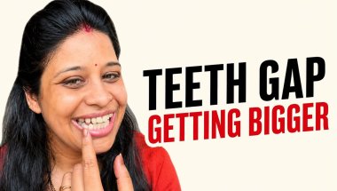 29 April 2026 It’s getting worse before it gets better… 💔 My braces journey reality#teethgap #real