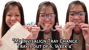 My Invisalign Tray Change: Tray 3 out of 6 | Week 2 | Experience | Tagalog