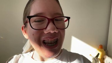 Braces journey!