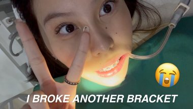 a random day in my life...? (our shopee office, braces, and k-pop!)
