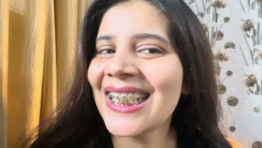 Braces ko deep clean keise krte hai#viral #dentist #dentalclinic #trending #youtube #teeth