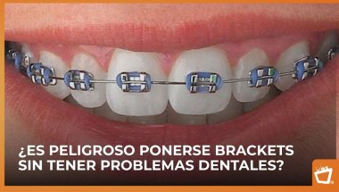 ¿Es peligroso ponerse brackets sin tener problemas dentales?