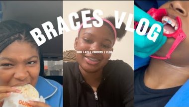 Braces vlog (uncut) 🤓😛