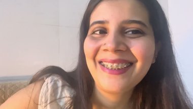 Braces mei khana pina keisa rakhna chahiye #viral #dentist #trending #youtube #dentalcare #teeth