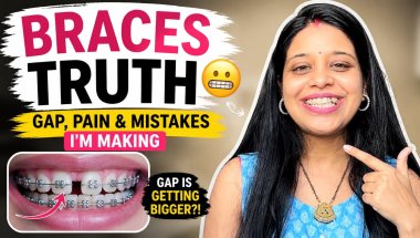 Braces Truth 😬 Gap, Pain & Mistakes I’m Making#smiletransformation#reallife