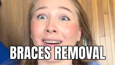I GOT MY BRACES OFF 😭✨ | Braces Removal + Before & After Reveal
