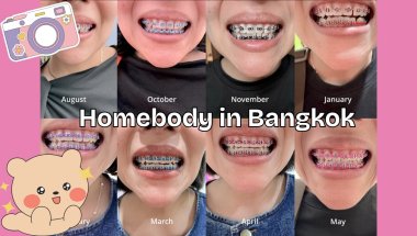 Homebody in Bangkok: 8 MONTHS OF BRACES The Transformation! ✨
