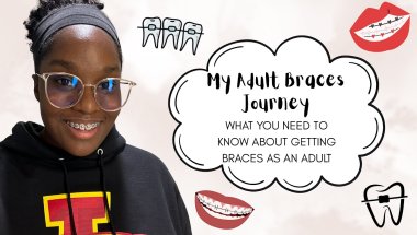 Braces As An Adult | What To Expect | What's In My Braces Bag