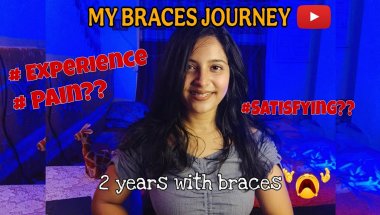 Real Talk About Braces ⚠️❗|| Worth it Or NOT ⁉️
