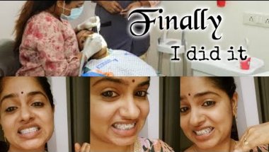 🦷അതിനും ഒരു തീരുമാനം ആയി/പല്ലിൽ കമ്പിവേലി കെട്ടി😁 /Malayalam/ @OnMyWayByAchooz