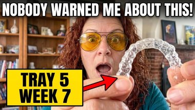 Tray 5, week 7, Nobody warned me about this! Invisalign journey ❤️