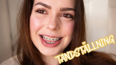 Tandställning när man är 35 år gammal + käkoperation