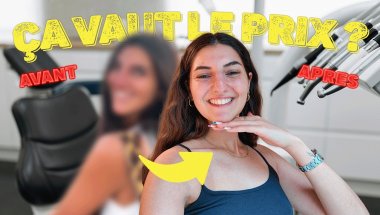 INVISALIGN : CE QUE J'AURAIS AIMÉ SAVOIR AVANT DE COMMENCER (FAQ, AVANT APRÈS...)