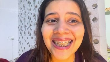 My 14 Months braces tightening pain #viral #dentist #youtube #trending #teeth #dentist