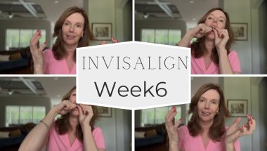 🦷Invisalign Week 6 | What’s a trumpet?