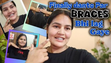 आज से braces journey शुरू 😁।। अब से सिर्फ सॉफ्ट फूड खाना पड़ेगा 😱।। हेयर कट भी करवा दिए😱।।