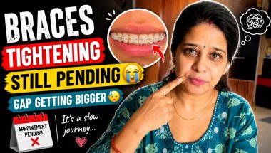 11 May 2026 “Still waiting for my braces tightening appointment 😭🦷#teethgap #bangalorevlogs