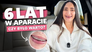 6 LAT W APARACIE ORTODONTYCZNYM 😳 Czy było warto?