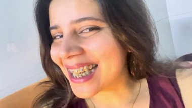 Only 16days ago ,doctors will remove my braces #viral #dentist #vlog #trending #youtube #teeth h