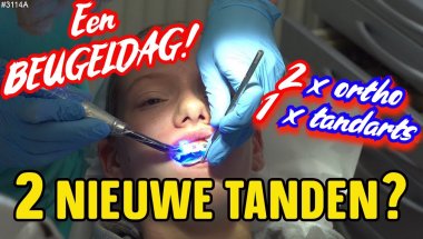 Een BEUGEL DAG! De Tandarts maakt 2 NIEUWE TANDEN? Deed dit PIJN? Dit moet je even zien  #3114A