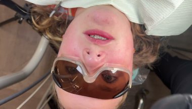 Flossing Braces Trick