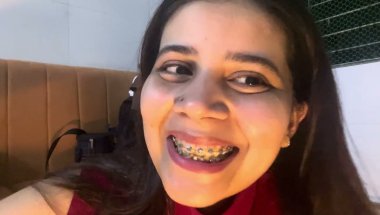 14days ago,Doctor will remove my braces#viral #dentist #youtube #trending #teeth