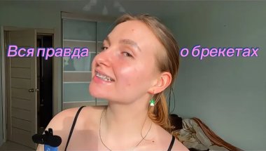 Вся правда о брекитах. Мой опыт.