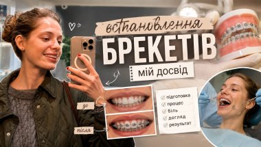 БРЕКЕТИ | все що треба знати перед встановленням | мій досвід