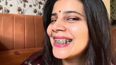 13 day age ,doctor will remove my braces🤭#viral #dentist #youtube #teeth #trending