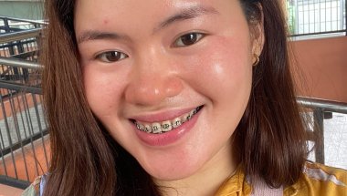 7th. adjustment and I choose a  black rubber for my braces 🤭
