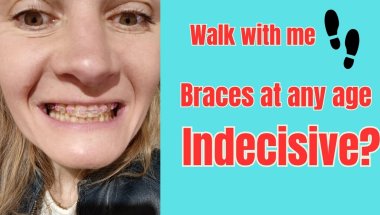 Should I get them now or? Indecisive? #braces #metalbraces #dentalbraces #indecision #smile