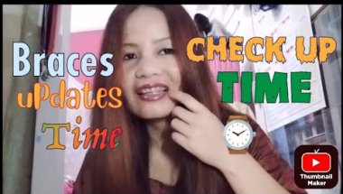 Monthly braces checked up || change Spring, change powerchain #adultbraces #monthlycheckup #braces