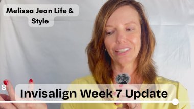 🦷Invisalign Week 7 | Take them out!