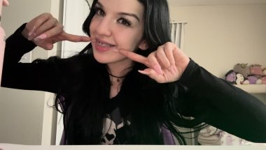 unfortunately i have braces now (1 MONTH UPDATE)