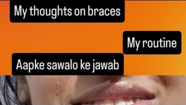 My 11th months journey with braves? 'V😇🙆‍♀️🥰#braces #love #smiledesigndental #dentist #youtubevideo