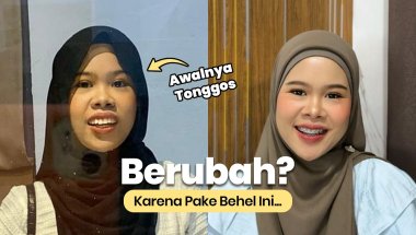 SHARING BEHEL | Tonton video ini sebelum pakai behel‼️
