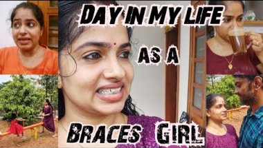 #braces ഇട്ടതിനു ശേഷം ഉള്ള എന്റെ #1st Day In My Life 😁🦷/എനിക്ക് എന്തിന്റെ കേടായിരുന്നു😡🙆 Braces vlog
