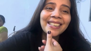 Braces nikalte time pain bhi hota hai#dentist #viral #youtube #trending #vlog #shortvideo #teeth h