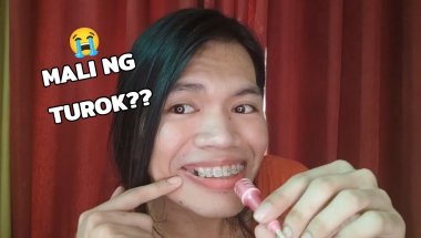BUNGAL NA AKO! 🦷MAY 2021 4TH WEEK DAILY VLOG🎥