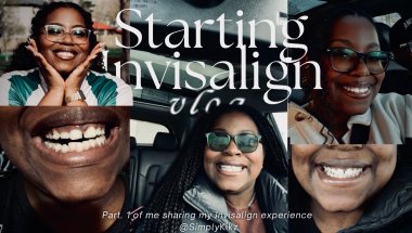 Starting my Invisalign Journey!