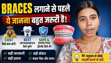 Braces Treatment Guide 2026 🦷💯| Cost kaise Kam Kare +sahi Doctor Kaise Chune 😰#braces #bracesjourney