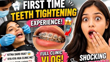 My first teeth tightening day// #braces #trending #shortvideo