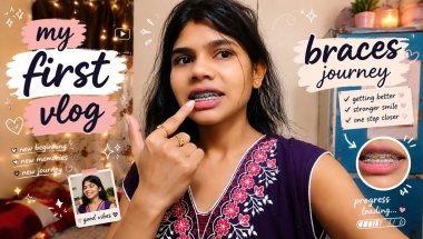 Finally uploaded my first vlog 🎥💖Braces journey starts here ✨|| braces journey😊